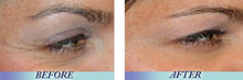 Carregar imagem no visualizador da galeria, Retinol Vitamin A 2.5% Serum for Anti Aging Wrinkle Acne Facial Face Beauty - Beijooo